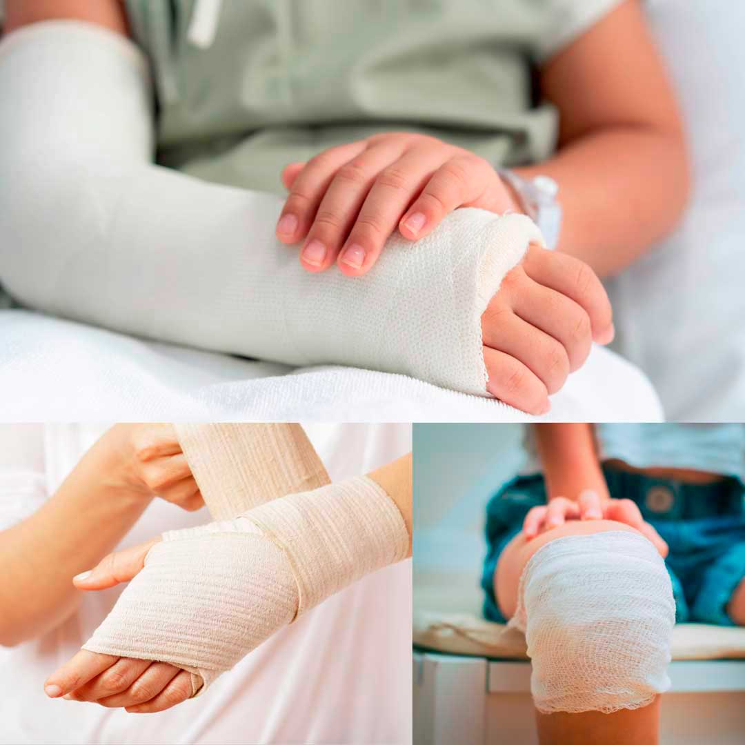 Imobilização e gesso