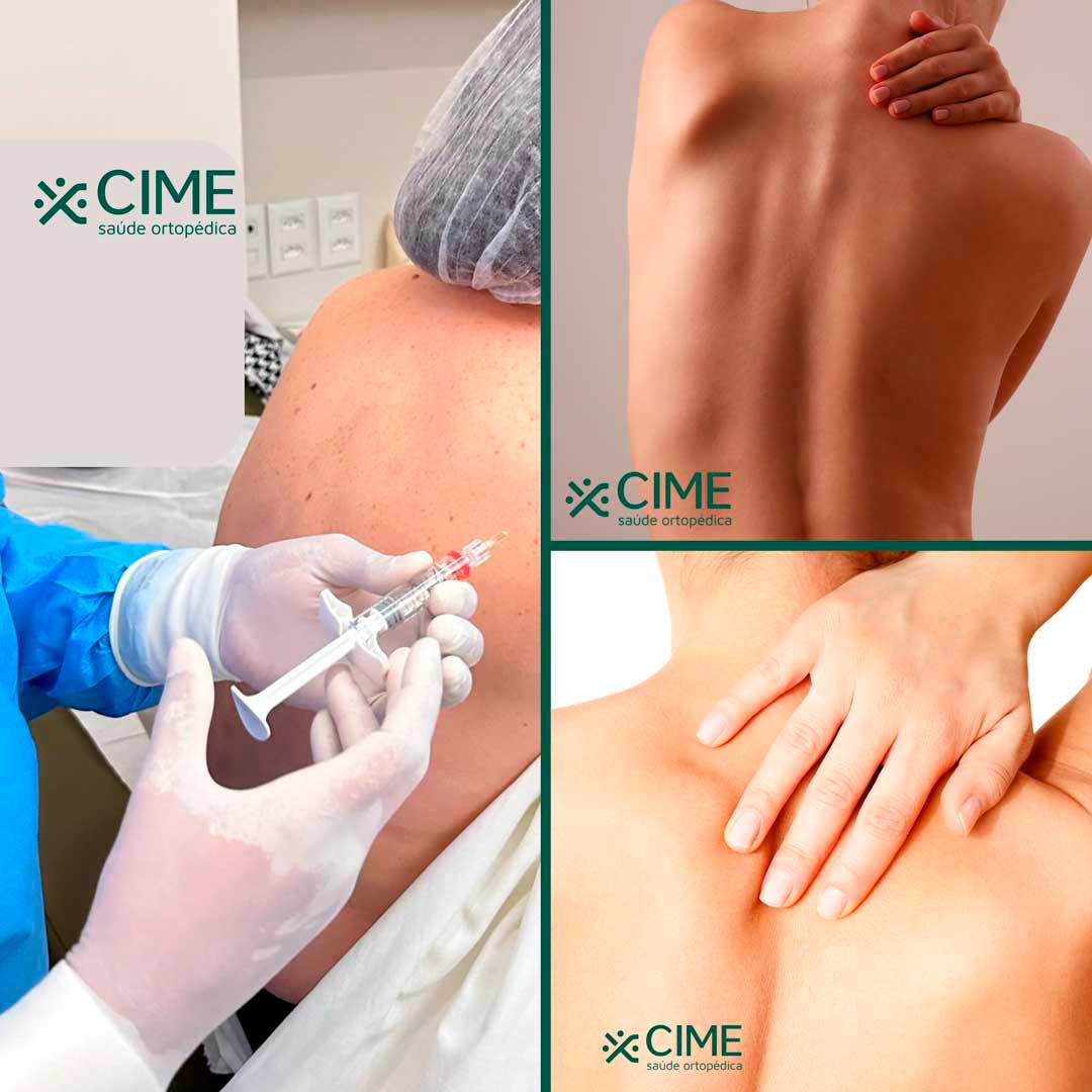 Infiltração em ponto-gatilho