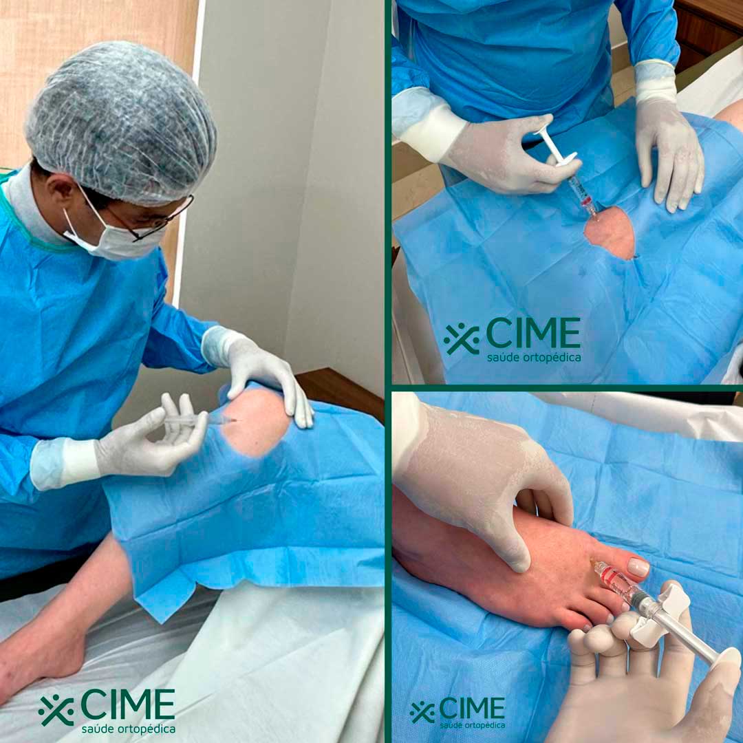 Viscossuplementação